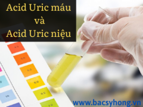 Xét nghiệm acid uric trong nước tiểu với người bệnh Gút