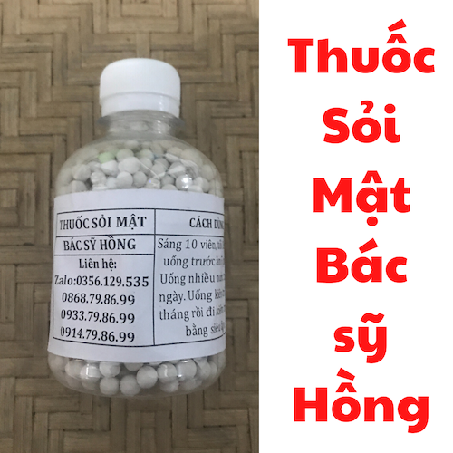 Thuốc sỏi mật Bác sỹ Hồng